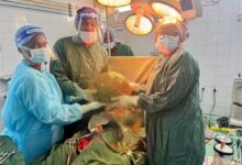 Removidos 20kg de massa abdominal a mulher de 65 anos