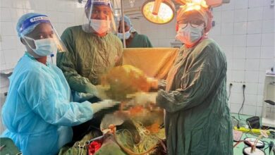 Removidos 20kg de massa abdominal a mulher de 65 anos