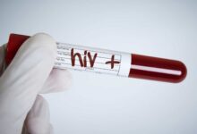 Registados mais de nove mil novos casos de HIV no Niassa