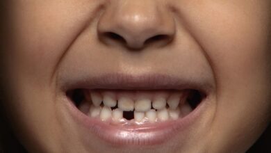 SAIBA MAIS: Sobre queda e perda dos dentes de leite