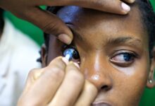 LENTES DE CONTACTO NO INFORMAL: Perigo à espreita na busca por novos padrões de beleza