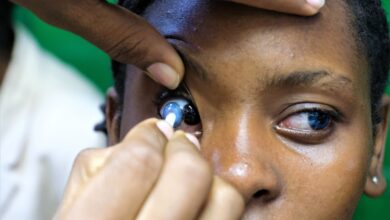 LENTES DE CONTACTO NO INFORMAL: Perigo à espreita na busca por novos padrões de beleza