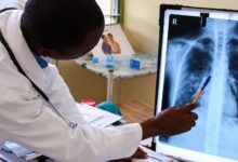 Moçambique mantém foco em doenças torácicas