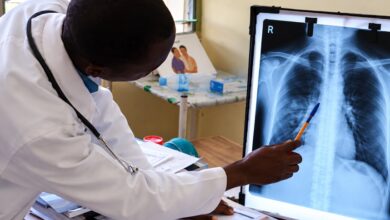 Moçambique mantém foco em doenças torácicas
